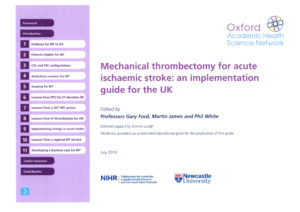 Mechanical Thrombectomy for Acute Ischaemic Stroke: an Implementation Guide for the UK 