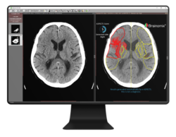 brain scans images on computer